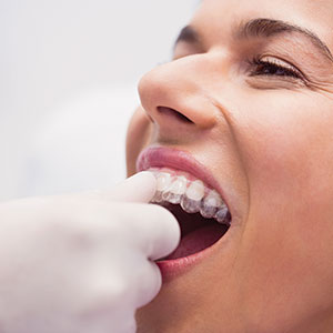 Best Dentist in South Delhi